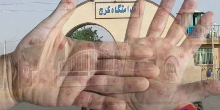 وضعیت فاجعه بار بهداشتی در زندان مرکزی کرج