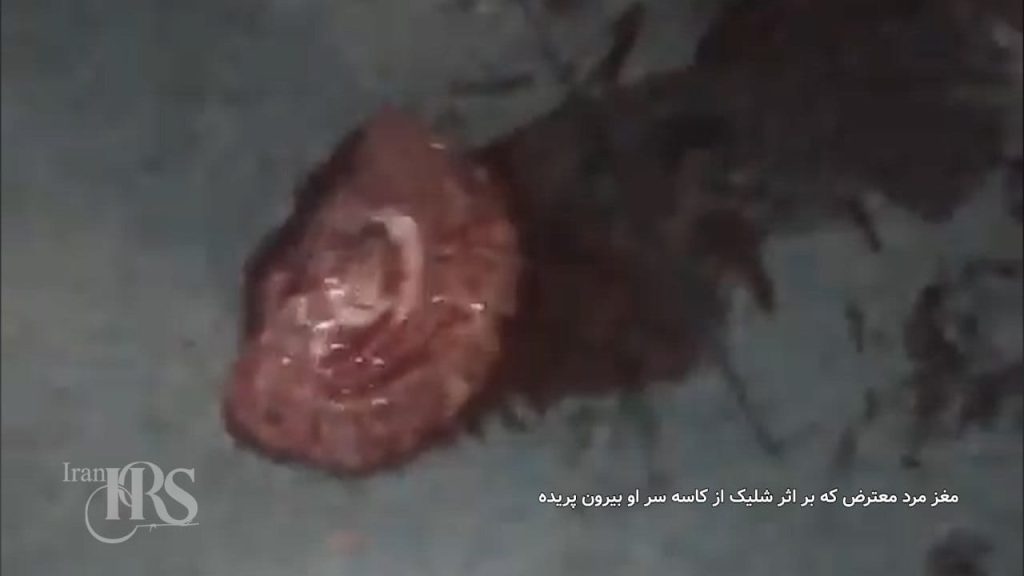 شلیک با سلاح سنگین به سر جوان معترض و متلاشی شدن مغز او در اعتراضات سراسری ۱۴۰۴
