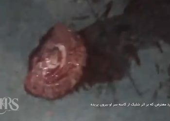 شلیک با سلاح سنگین به سر جوان معترض و متلاشی شدن مغز او در اعتراضات سراسری ۱۴۰۴