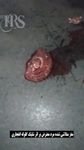 شلیک با سلاح سنگین به سر جوان معترض و متلاشی شدن مغز او در اعتراضات سراسری ۱۴۰۴