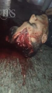 شلیک با سلاح سنگین به سر جوان معترض و متلاشی شدن مغز او در اعتراضات سراسری ۱۴۰۴