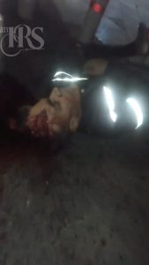 شلیک با سلاح سنگین به سر جوان معترض و متلاشی شدن مغز او در اعتراضات سراسری ۱۴۰۴