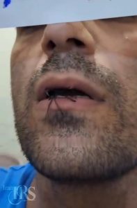 زندان قزلحصار؛ هشتمین روز اعتصاب غذای ۱۵۰۰ زندانی محکوم به اعدام؛ آغاز اعتصاب خشک و افزایش نگرانیها