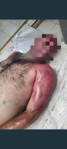 زندان دستگرد اصفهان؛ افشای اسناد، تصاویر و گزارش پزشکی قانونی از سرکوب خونین زندانیان | پرونده ویژه